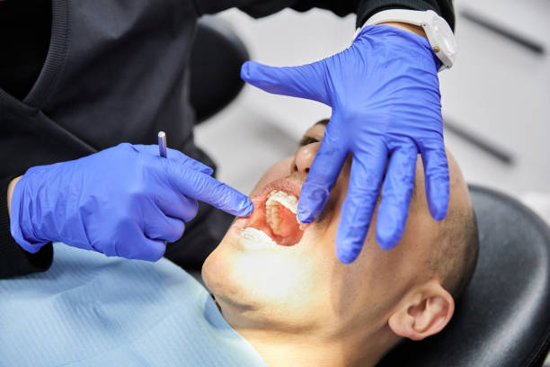 Best Dental Abscess Treatment in Greenfield, CA
